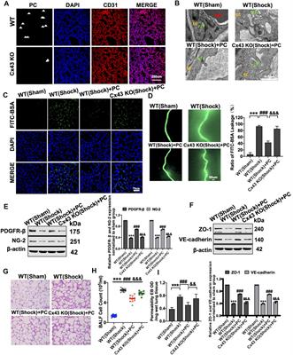 The protective effect of pericytes on vascular permeability after hemorrhagic shock and their relationship with Cx43